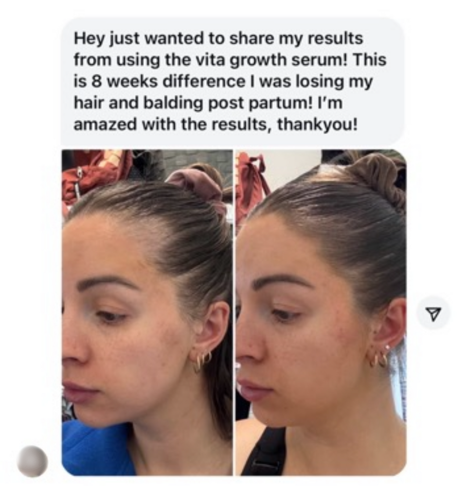 Vita-Growth Scalp Serum