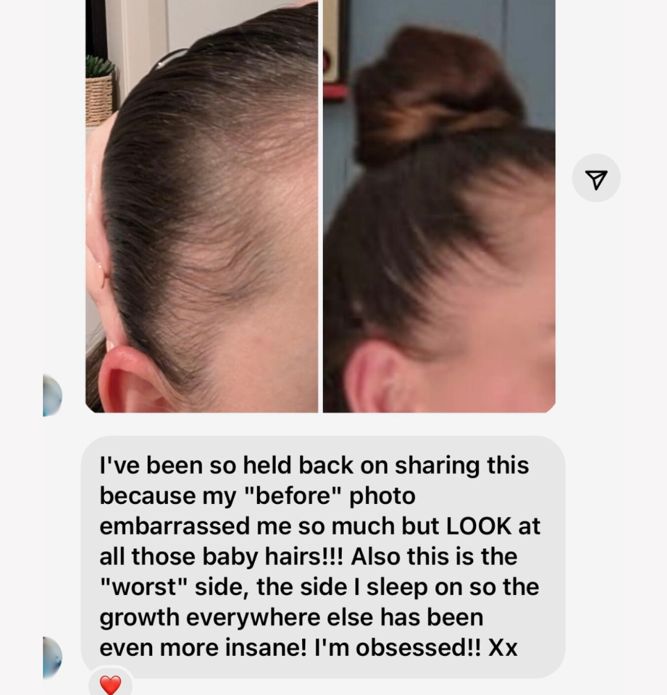 Vita-Growth Scalp Serum
