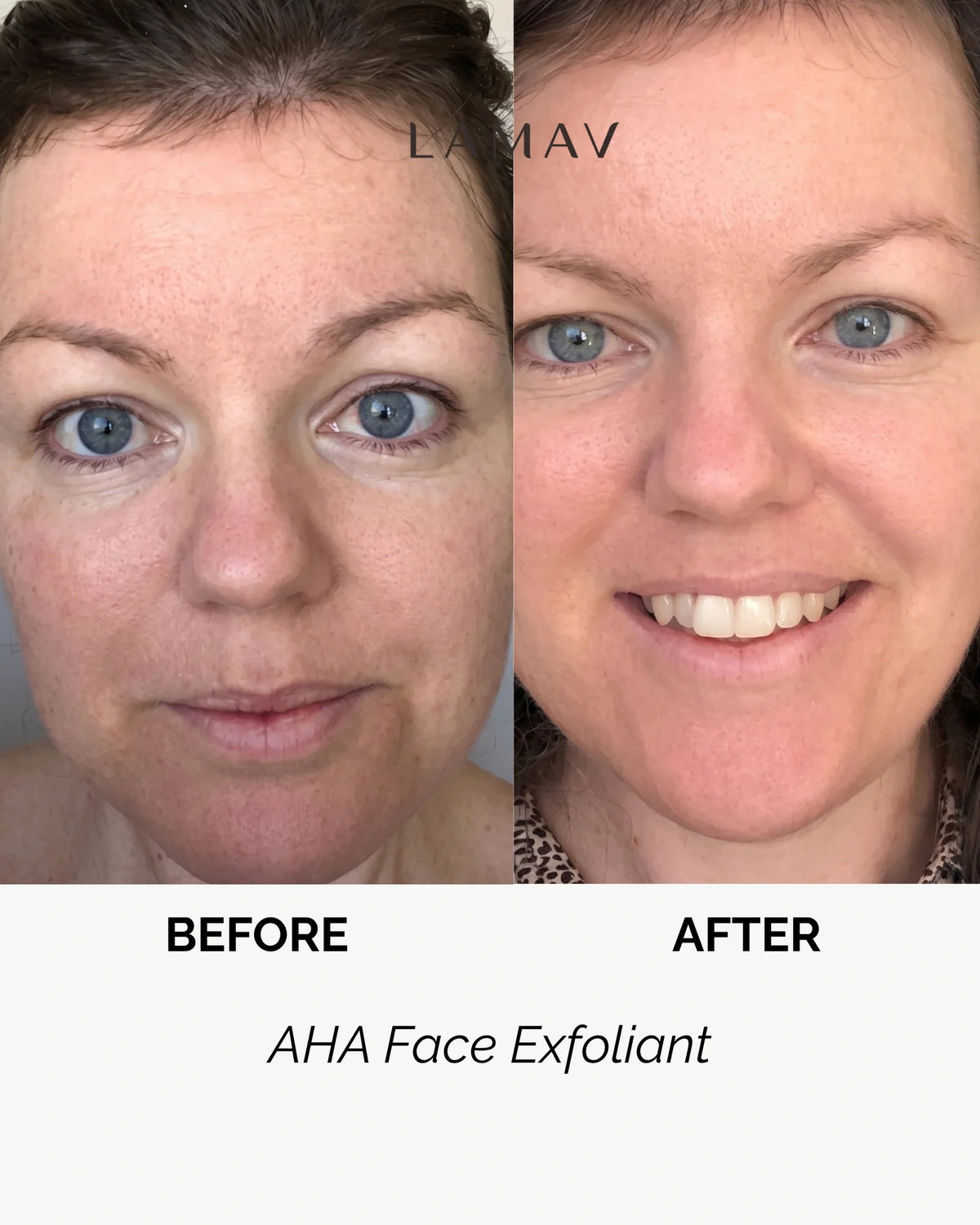 AHA Face Exfoliant